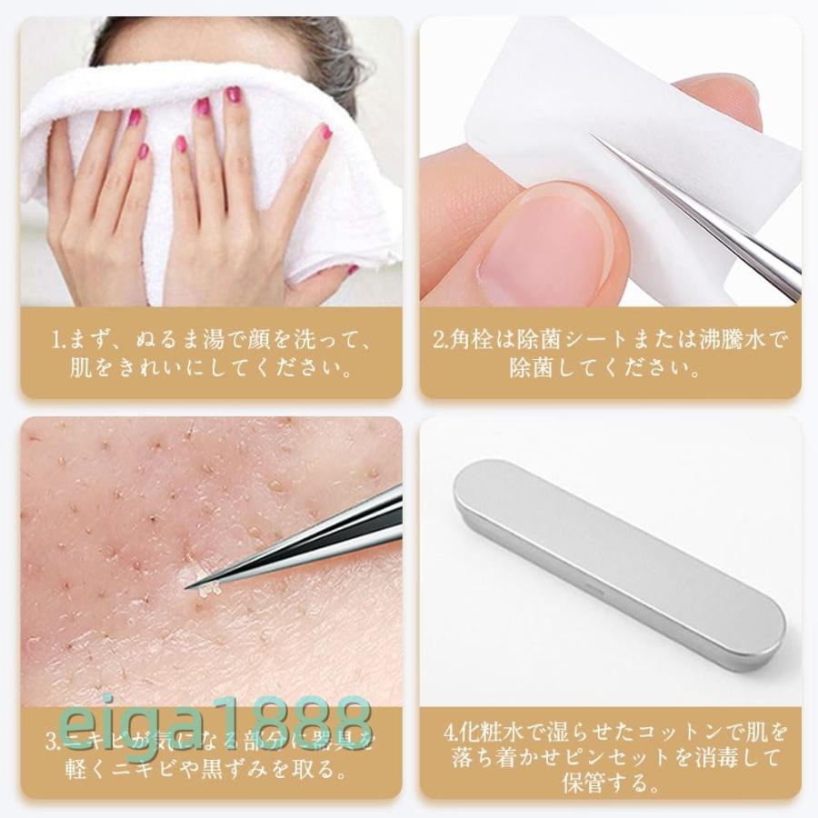 精密ピンセット 3 本セット 先端幅 0.1mm 角栓取り / ニキビ取り