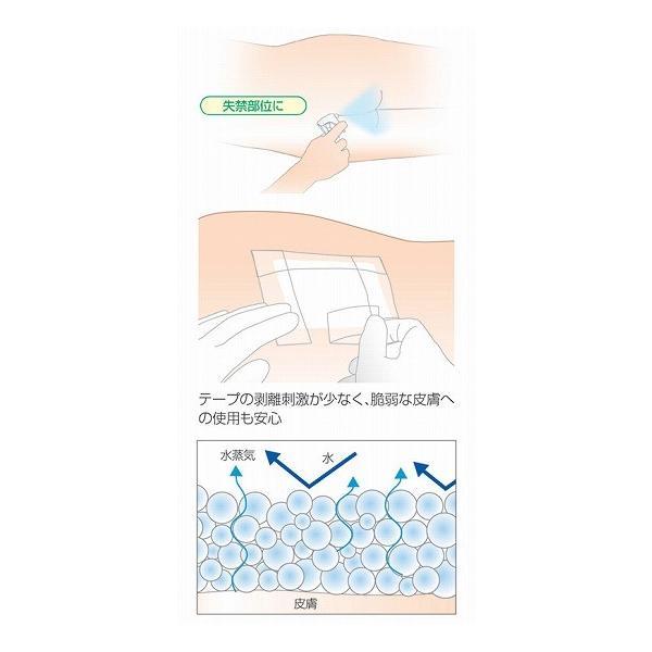 リモイスコート 17711 30mL  アルケア 介護用品 | ALCARE | 01