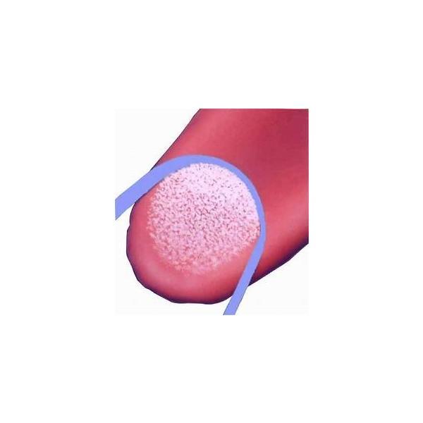 (代引き不可）クリーンタング エコノミー 病院・施設用 18本入 ユニロック 介護用品 |  | 02