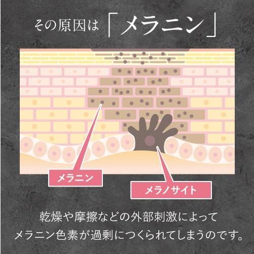 デリケートゾーン 黒ずみ クリーム 乳首 VIO 脇 全身 美白 保湿 ホワイトニング 医薬部外品 薬用 ハクトーンクリーム 60g ハイドロキノン誘導体 トラネキサム酸｜ekuserennto｜09