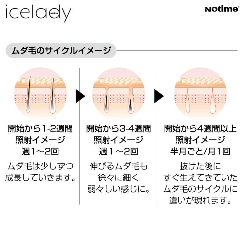 脱毛器 アイスレディ icelady IPL脱毛器 家庭用光美顔器 notime 脱毛器 アイスレディ icelady IPL脱毛器 家庭用光美顔器 notime