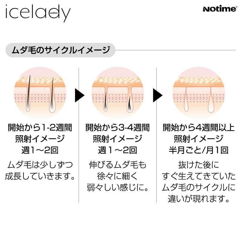 脱毛器 アイスレディ icelady IPL脱毛器 家庭用光美顔器 notime SKB