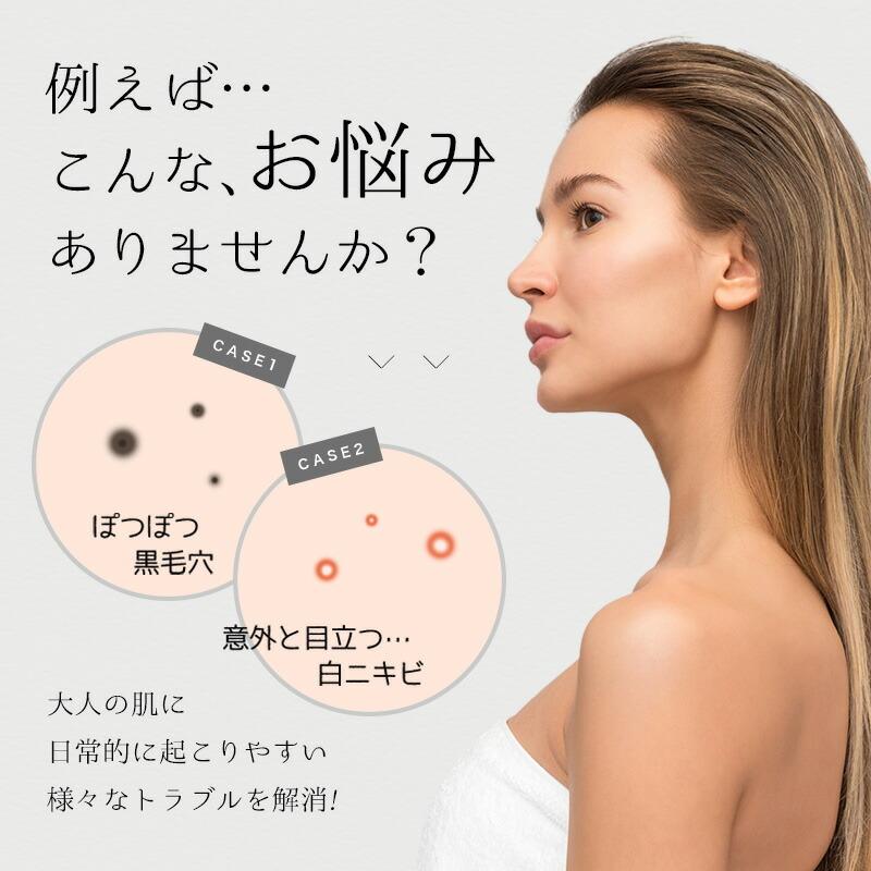 毛穴ケア 角栓取り ピンセット 5本 セット ニキビ コメド 毛穴ケア 角栓取り ピンセット 5本 セット ニキビ コメド