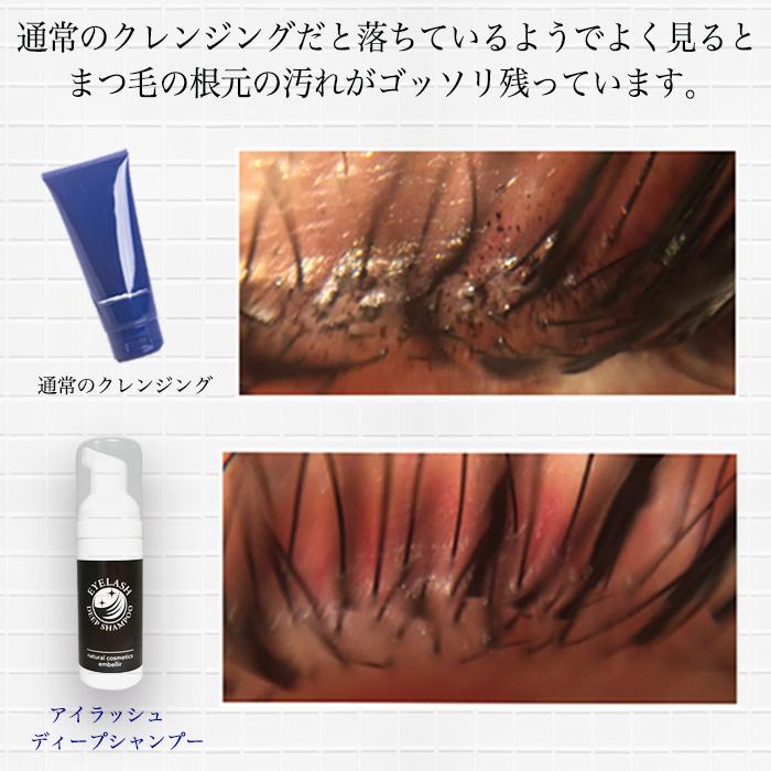 アイシャンプー まつ毛ダニ アイラッシュディープシャンプー まつ毛育毛剤 いつでも送料無料