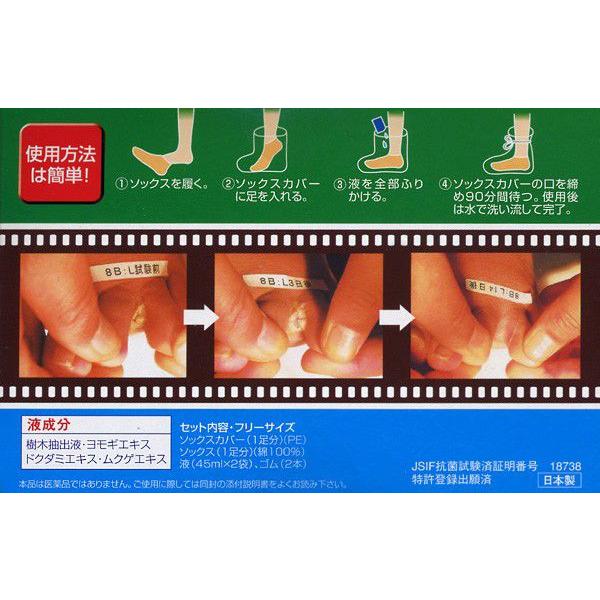 カイカイ ナイト2 天然成分100 水虫用 フットケア かかとケア 角質ケア 浸漬方式 かいかいないと ゆうパケット対応 M便1 2 Shinrin1 アンシャンテマーケット 通販 Yahoo ショッピング