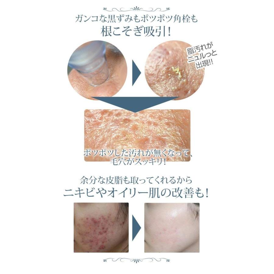 Ey 穴吸引器 毛穴クリーン 美顔器 電動 黒ずみ取り 吸引力5階段調節 吸収カップ4種類 毛穴洗浄 角栓クリア ニキビ 毛穴汚れ イチゴ鼻 しわ 角質ケア Hy Enjoy Life 通販 Yahoo ショッピング