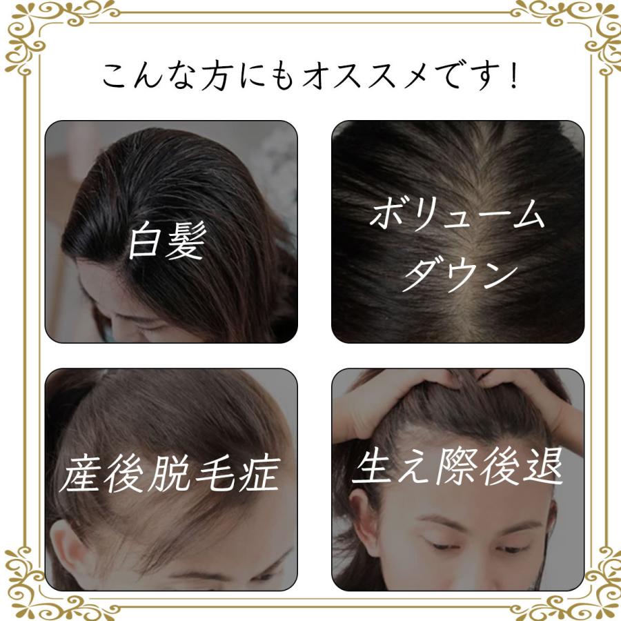 ウィッグ 前髪ウィッグ 部分ウィッグ ポイントウィッグ 自然 ナチュラル トップカバー ワンタッチ エクステ Maegamiwiggu3 Enter Key 通販 Yahoo ショッピング