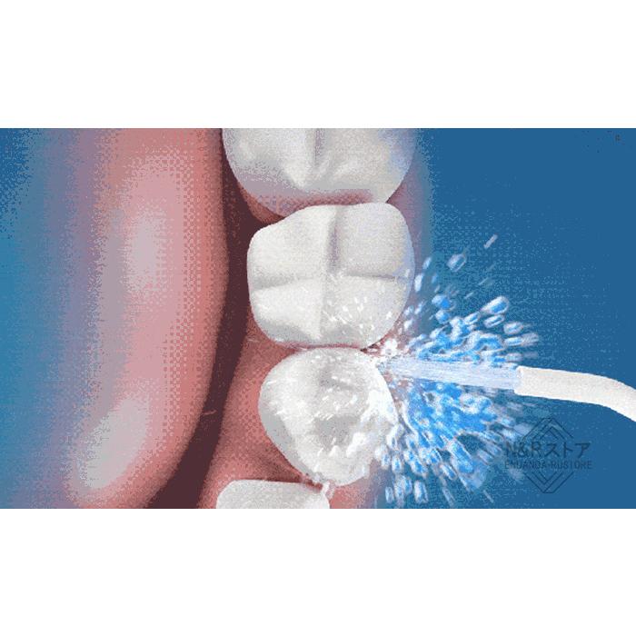 口腔洗浄機【歯科医監修】【一台3役】 【超音波水流】 メモリ機能  歯間 ジェット 矯正 歯周ポケット 口腔ケア 電動歯ブラシ 子供 大人 usb充電 ipx7防水｜enuanda-rustore｜09