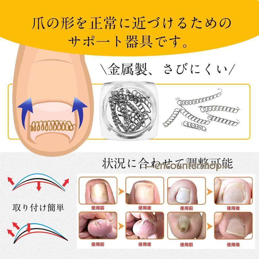 巻き爪 矯正 巻き爪チェーン 治療 爪ワイヤー テープ付き 12個 自宅で治す 矯正器具 爪切り ネイルエイド セルフケア サポーター｜enyo2020｜05