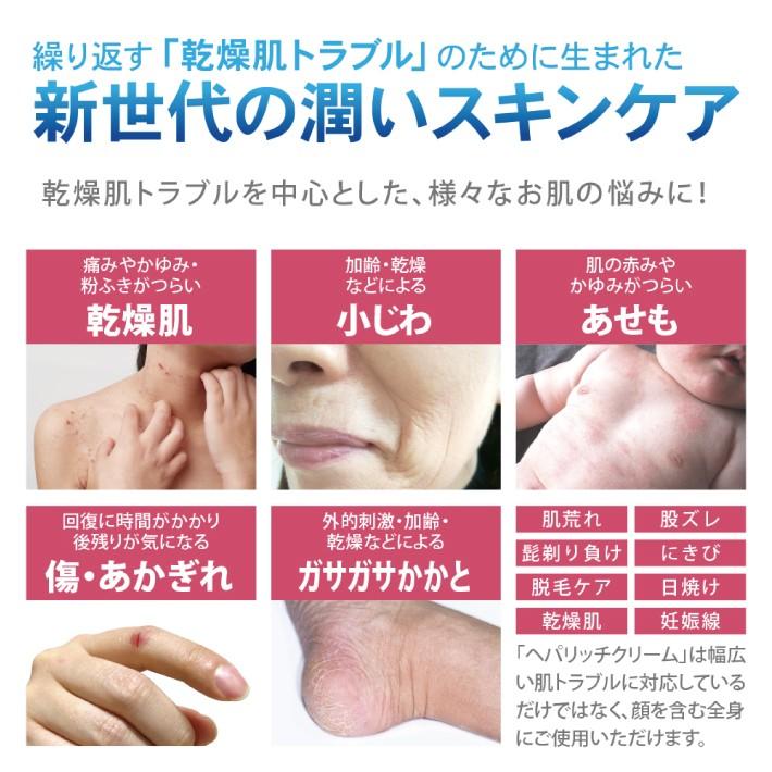 薬用 ヘパリッチクリーム 30g 医薬部外品 保湿クリーム スキンケア
