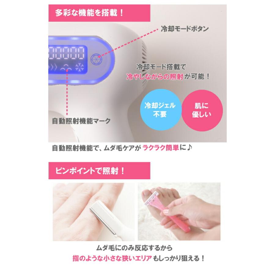 アデランス 光エステ ビューシー 光美容器 脱毛器 レディース アデランス 光エステ ビューシー 光美容器 脱毛器 レディース