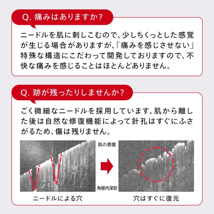 CONC（コンク） 【公式】 ブライトインジェクション 2.5mL ｜ マイクロ