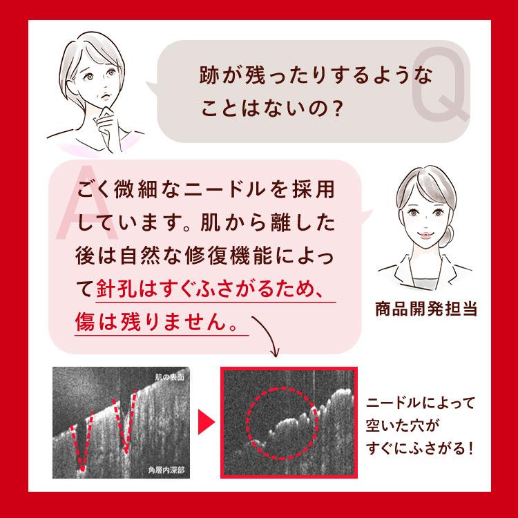 CONC（コンク） 【公式】 リンクルインジェクション 2.5mL ｜ マイクロ