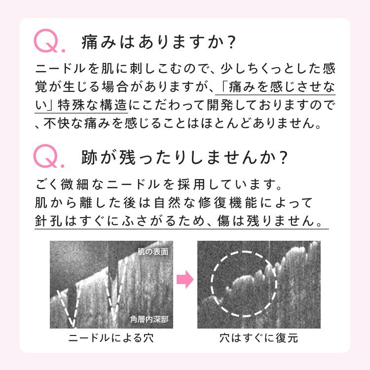 【公式】 CONC PC リッチショット 2.5mL ｜ CONC LABO コンクラボ マイクロニードル美容液 注入型美容液 針美容液 保湿 コラーゲン ペプチド | CONC | 09