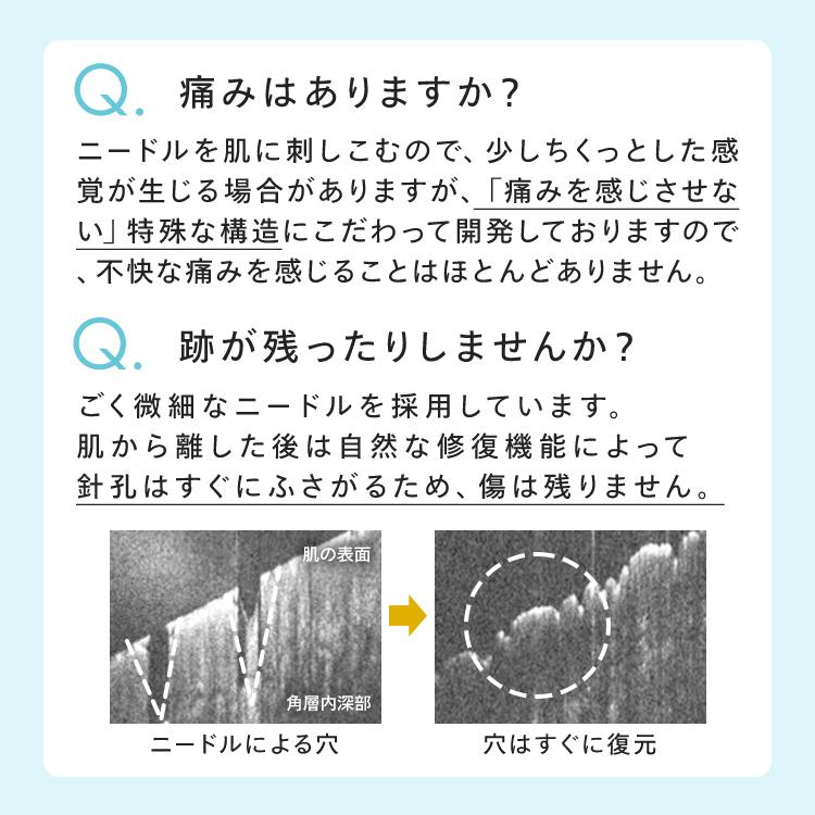 【公式】 CONC ヒアロシカ リッチショット ｜ CONC LABO コンクラボ マイクロニードル美容液 注入型美容液 針美容液 保湿 ヒアルロン酸 CICA エイジングケア | CONC | 09