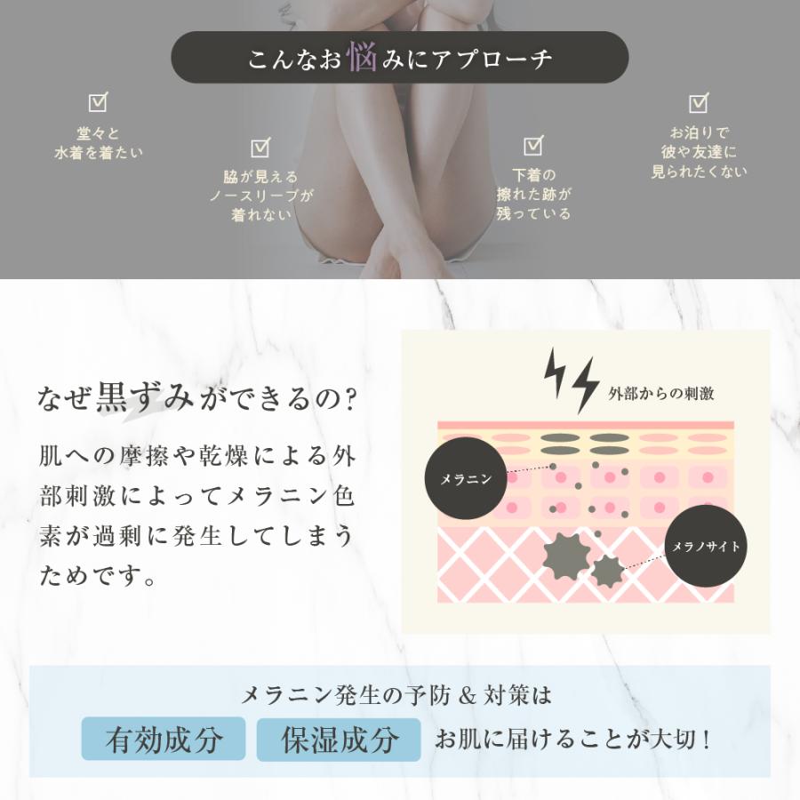 (クーポン配布中) デリケートゾーン 黒ずみ 黒ずみクリーム 黒ずみ対策 美白 ホワイトニング VIO ボディクリーム かかとクリーム 医薬部外品 50g kikimate | kikimate | 03
