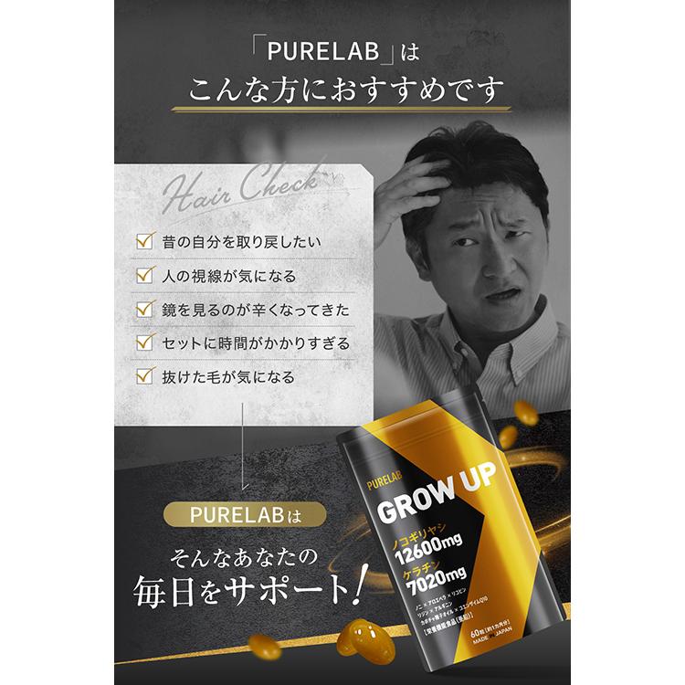 ノコギリヤシ サプリ 12600mg【レビューでもう一袋プレゼント】ケラチン のこぎりやしサプリメント 発毛促進 AGA 抜け毛 国内製造 30日分 PURELAB :nokogiriyashi-001:いいねONLINE 健康美容 研究所 - 通販 - Yahoo!ショッピング ノコギリヤシ サプリ 12600mg【レビューでもう一袋プレゼント】ケラチン のこぎりやしサプリメント 発毛促進 AGA 抜け毛 国内製造 30日分 PURELAB :nokogiriyashi-001:いいねONLINE 健康美容 研究所 - 通販 - Yahoo!ショッピング