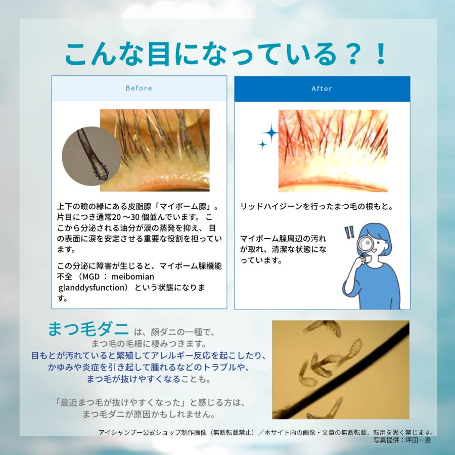 メーカー公式_アイシャンプーリフレッシュ95ml 目元シャンプー 目元ケア まつ毛ケア 花粉症ケア ドライアイ リッドハイジーン メンソール アイメイク まつ毛ダニ |  | 12