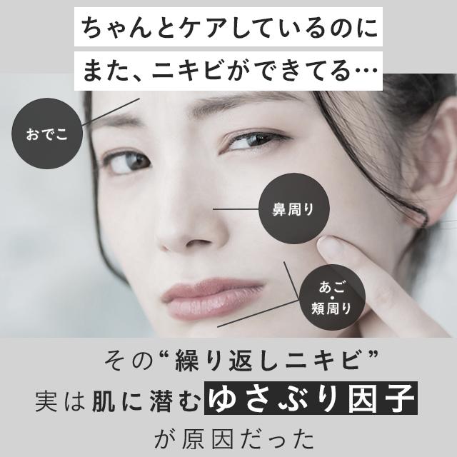 FANCL（ファンケル） アクネケア 化粧液 医薬部外品 3本 ニキビ 化粧水