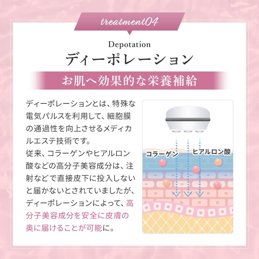 ベレガ 【シリアルNO付】セルキュア4Tプラス 美顔器 Belega Cell ベレガ 【シリアルNO付】セルキュア4Tプラス 美顔器 Belega Cell
