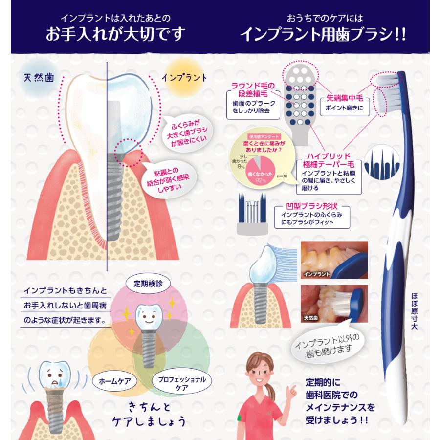 GC（ジーシー） 送料無料 ルシェロ I-20 インプラント 20本 歯科専売