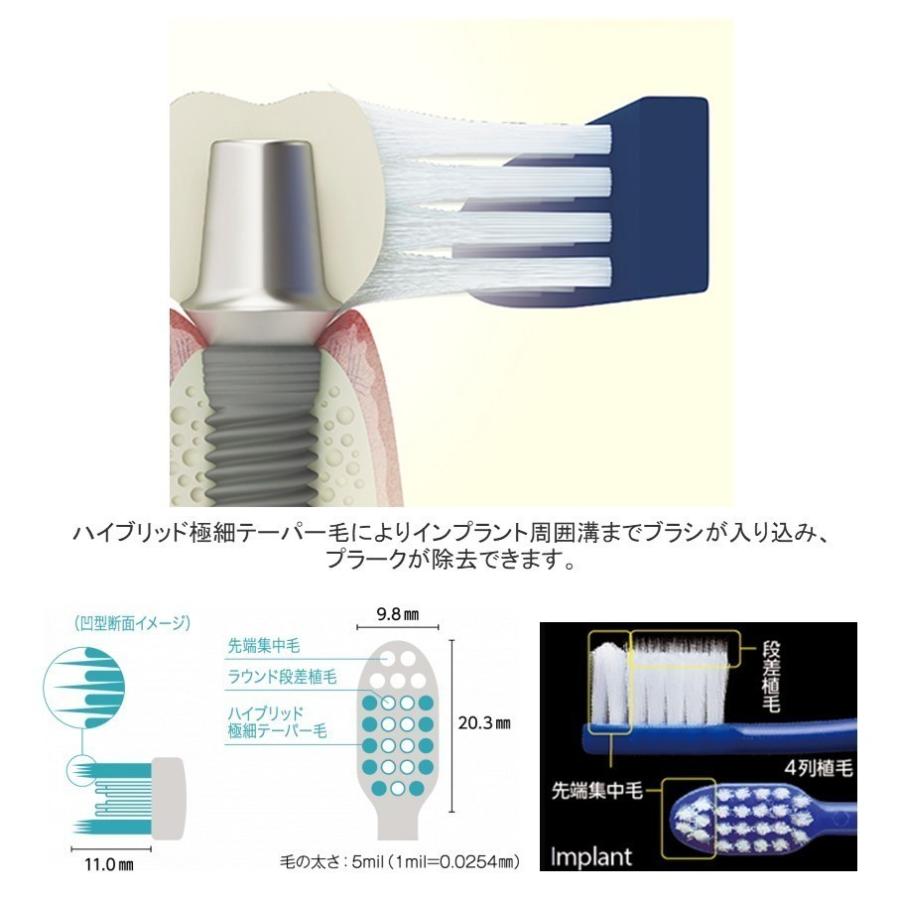 GC（ジーシー） 送料無料 ルシェロ I-20 インプラント 20本 歯科専売