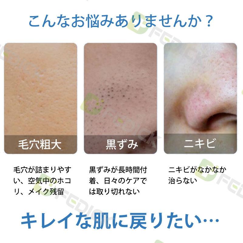 レビュー特典 毛穴吸引器 口コミ 毛穴ケア メンズ 角栓除去 美顔器 黒ずみ 鼻 Ems 効果 クレンジング 毛穴クリーン イチゴ鼻吸引 簡単操作 自宅 即納 C801xyq14 フェディック 通販 Yahoo ショッピング