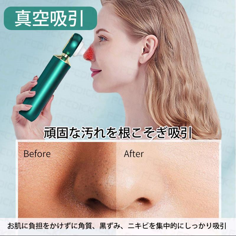 レビュー特典 毛穴ケア 美顔器 黒ずみ 角栓除去 鼻 毛穴吸引器 口コミ メンズ カメラ付き 毛穴クリーン イチゴ鼻吸引 Ems 効果 クレンジング 即納 Hty フェディック 通販 Yahoo ショッピング