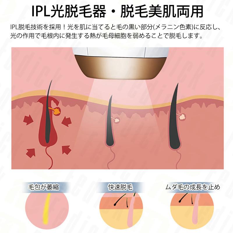 脱毛器 Vio対応 レーザー脱毛 光脱毛 フラッシュ 自動照射 Ipl脱毛器 家庭用 レディース メンズ 99万発照射 冷感脱毛器 5段階調節 即納 Linepilator01 フェディック 通販 Yahoo ショッピング