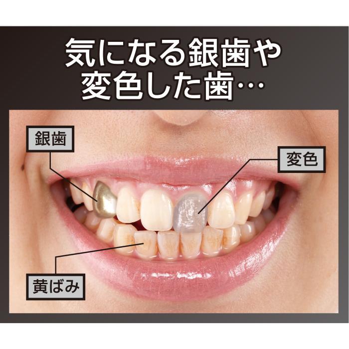 簡単セルフホワイトニング 白い歯 歯マニキュア ホーム