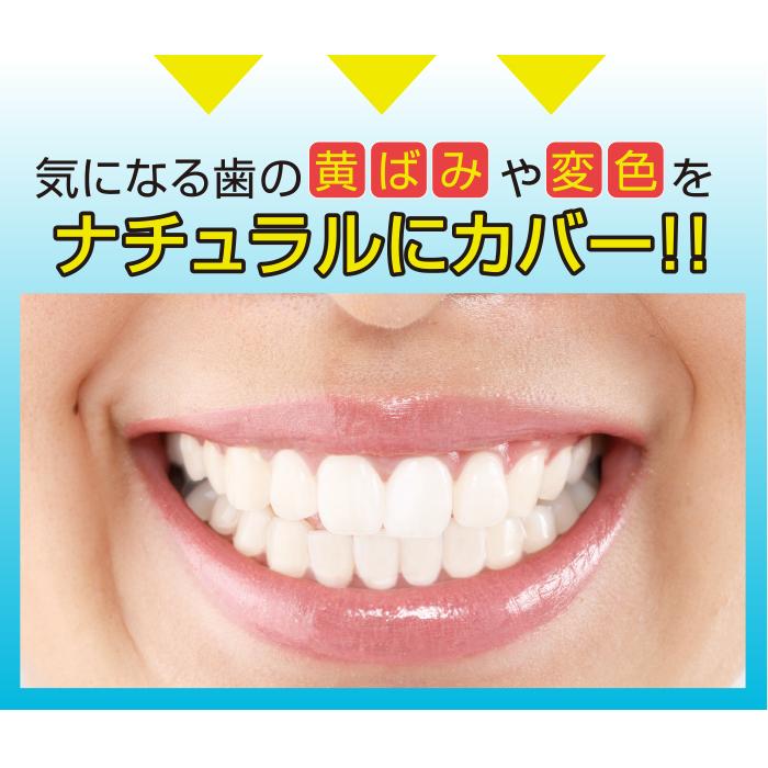 歯のセルフホワイトニング 楽天市場】ホワイトニングジェル 知覚過敏 セルフホワイトニング