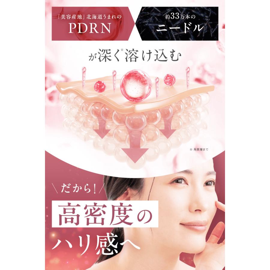 濃厚リフティング美容液 idio（イディオ） 北海道PDRN ニードリフトセラム 美容液 美容針