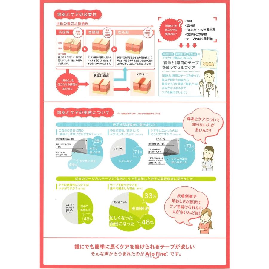 手術後の傷あとケアテープ アトファイン Ato Fine SS/S/M/L/LL 帝王切開 | アトファイン | 01