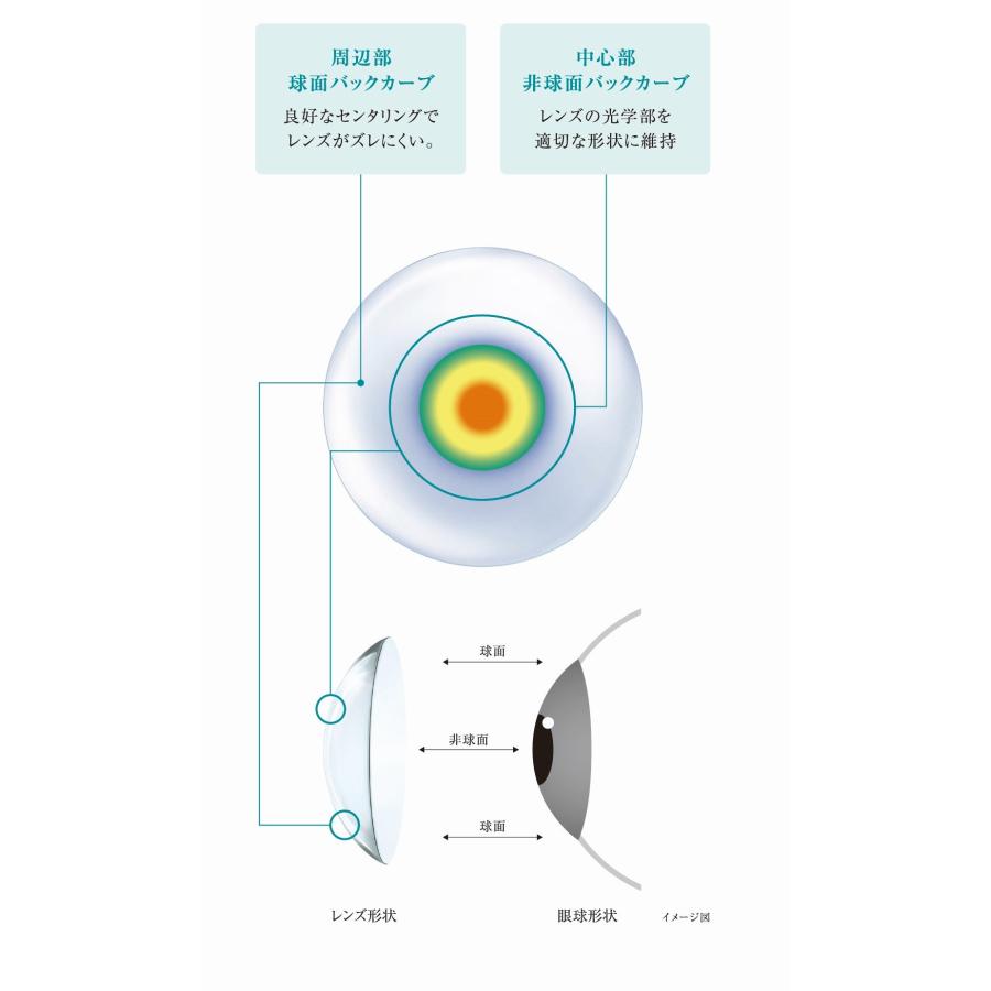 コンタクト アキュビューオアシス マルチフォーカル 6枚入&times;4箱 遠近両用 2ウィーク ジョンソンエンドジョンソン J&J 使い捨て 送料無料 2week
