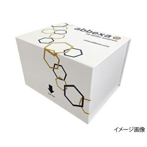 年最新海外 受注停止 アズワン ヒトウイルス検出elisaキットrubellavirusigg用 1キット 7417 51 ファーストpaypayモール店 通販 Paypayモール 人気ブランドを Int Academy Com