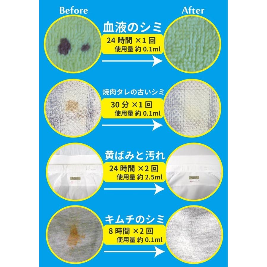 正規販売店 染み抜き剤 スポッとる BIGサイズ 150ml /海外×（NY