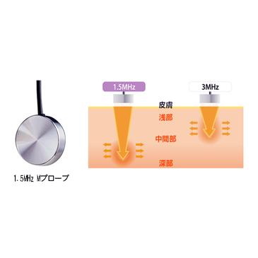 超音波治療器 イトー UST-770 伊藤超短波 : フジメディカルダイレクト
