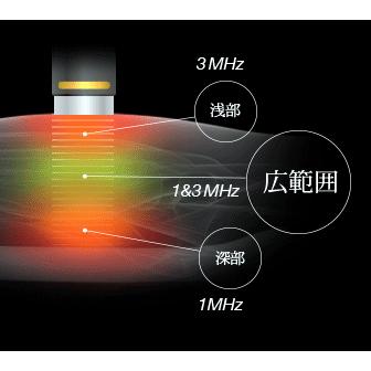 超音波治療器 フィジオソノ 標準セット 酒井医療｜fm-d｜08