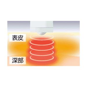 イトー SW-203 伊藤超短波の画像