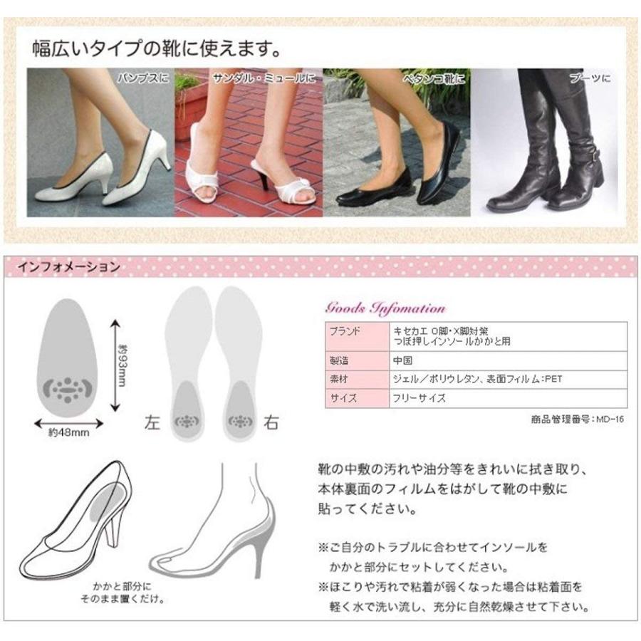 斜めソールでO脚・X脚をサポート キセカエ O脚・X脚対策 つぼ 斜めソールでO脚・X脚をサポート キセカエ O脚・X脚対策 つぼ