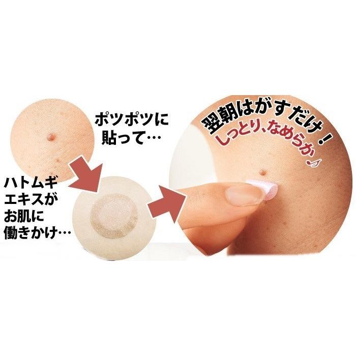 こじこじ！！家庭用 多機能 美肌ケア 美肌ケア 角質ケア 寝ながらハトムギ ジェルパッチ（コジット）美肌