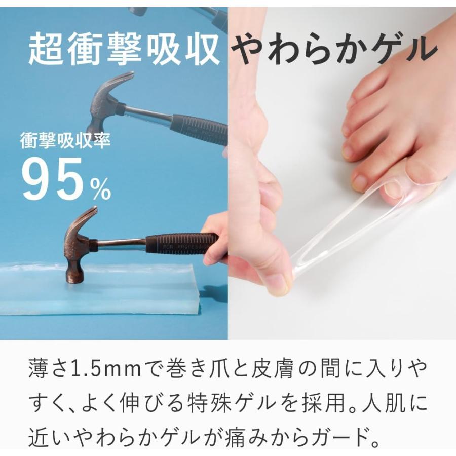 巻き爪用 ケアセット 巻き爪フットケアセット