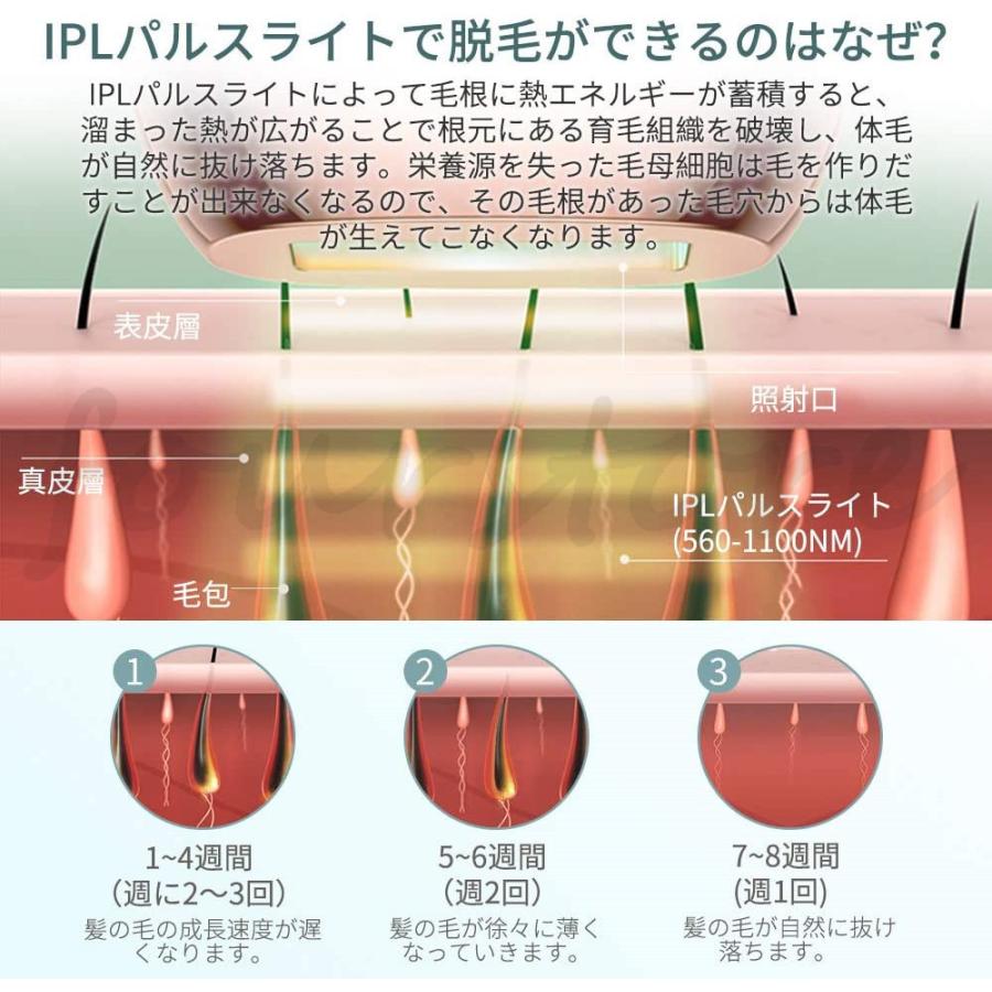 光美容器 光脱毛器 Ipl光脱毛器 Vio対応 レディース メンズ 脱毛機 家庭用脱毛器 光美容 ムダ毛処理 フラッシュ 顔 脇 髭 全身脱毛 自宅 5段階調整可能 連続照射 Cxyc 16 フォーストア 通販 Yahoo ショッピング