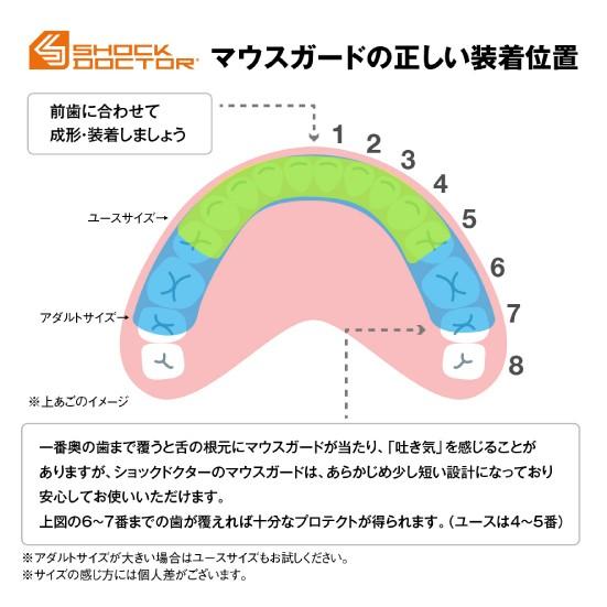 ShockDoctor ショックドクター マウスガード 8801A スーパーフィット アダルト 大人用 格闘技 武道 空手 キックボクシング 総合格闘後 ラグビー｜freedom-jpn｜06