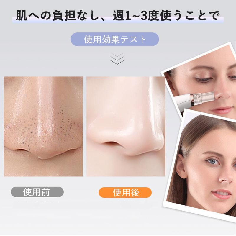 最新型 毛穴吸引器 毛穴ケア 美顔器 吸引 毛穴クリーン 角栓除去 最新型 毛穴吸引器 毛穴ケア 美顔器 吸引 毛穴クリーン 角栓除去