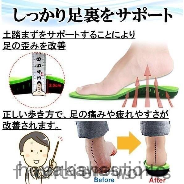 扁平足 インソール 医療用 矯正 衝撃吸収 土踏まず スニーカー スポーツ かかと サッカー 痛み 靴 靴下 O脚 扁平足 アーチサポート 立ち仕事 Fro64 Frontier Works 通販 Yahoo ショッピング