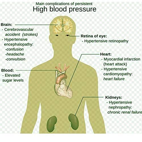 100%天然ハーブ高血圧パッチ、血圧降下 (5箱) 70パッチ