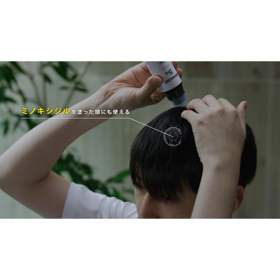 家庭用超音波スカルプケアデバイス SonoRepro（ソノリプロ） : 二子 