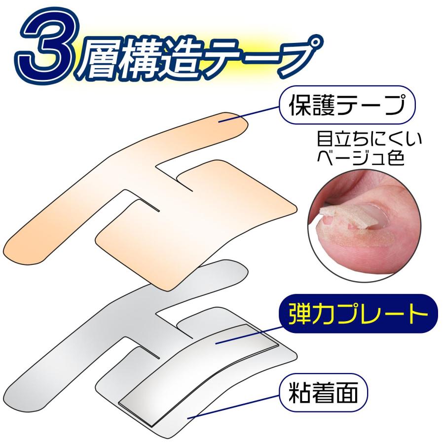 巻き爪ダブルケアテープ 60枚入 巻きつめ 巻爪 深爪 矯正 3層構造 器具