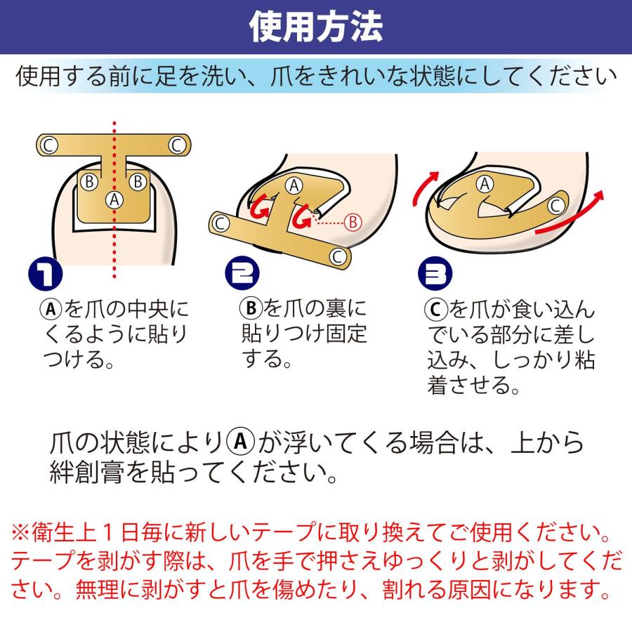 巻き爪ダブルケアテープ 60枚入 巻きつめ 巻爪 深爪 矯正 3層構造 器具